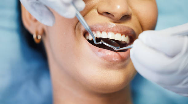 Best Dental Abscess Treatment in Ankeny, IA